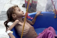 Yemen Pocket Of Famine Yemen Pocket Of Famine