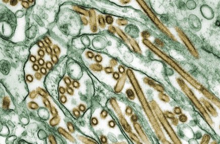 Le supervirus H5N1 (en doré sur cette image... (Photo PC)