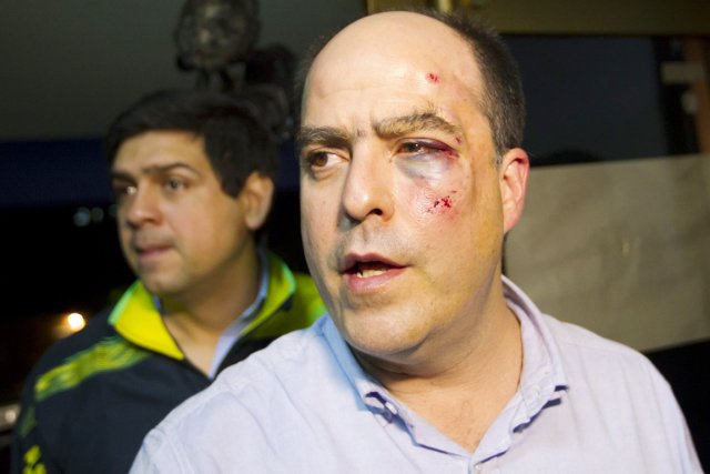 Bagarre au Parlement vénézuélien «Je ne suis pas le seul à avoir... (PHOTO CARLOS GARCIA RAWLINS, REUTERS)