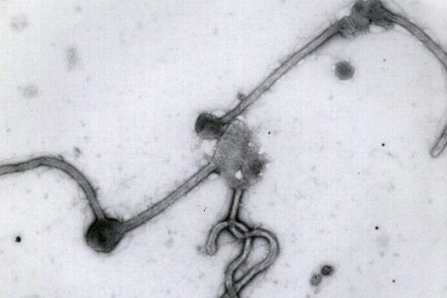 Ebola: Québec rassuré par la fausse alerte en Ontario À la fin du mois de juillet, la... (PHOTO ASSOCIATED PRESS)