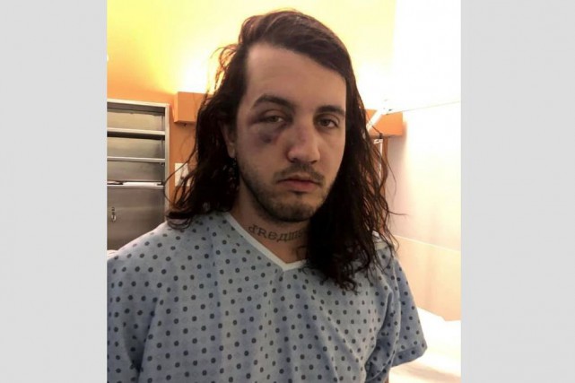 Agression homophobe à La Malbaie: des accusations sont déposées