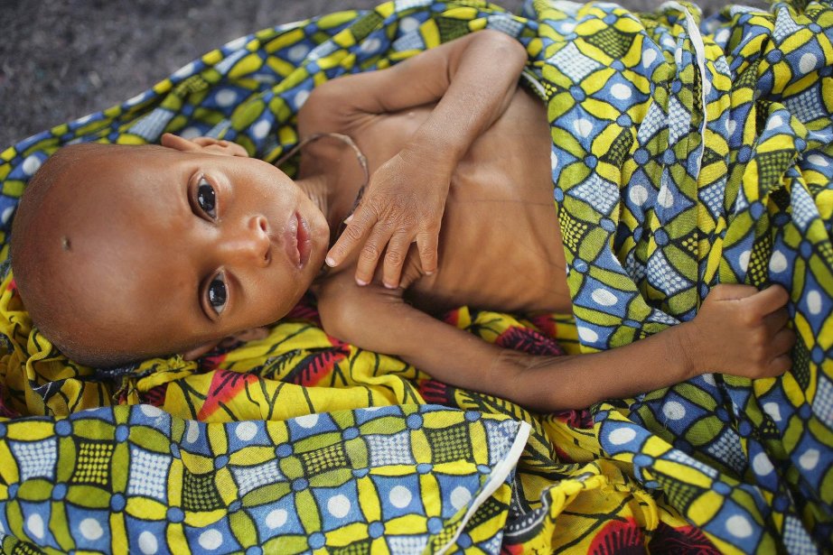Quels sont les risques de la malnutrition en afghanistan