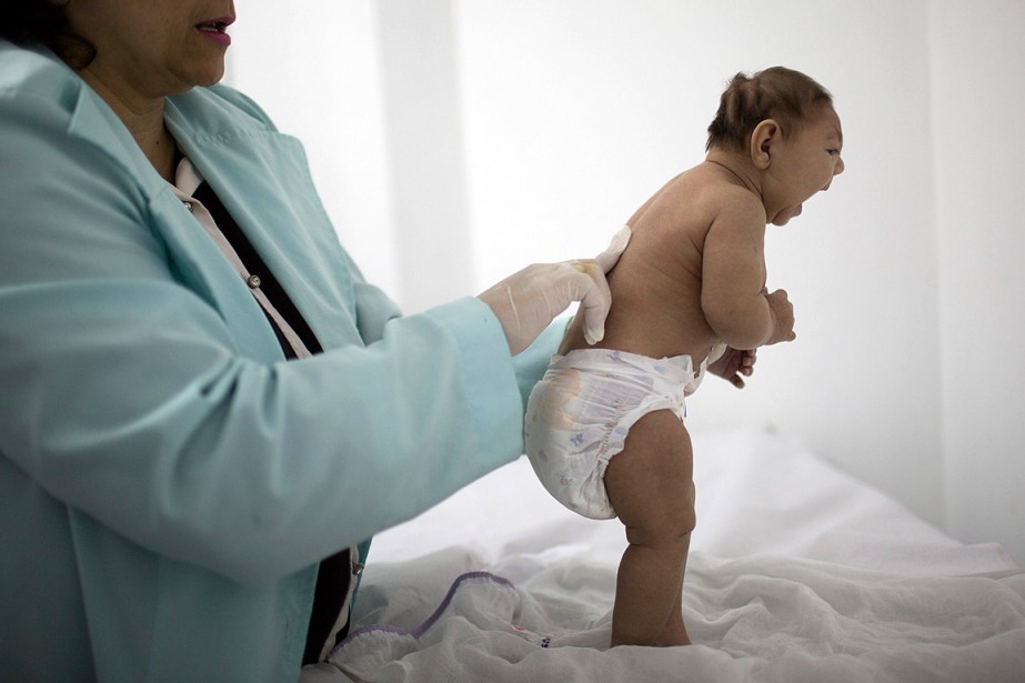 Zika Un Premier Bebe Atteint De Microcephalie En Europe La Presse